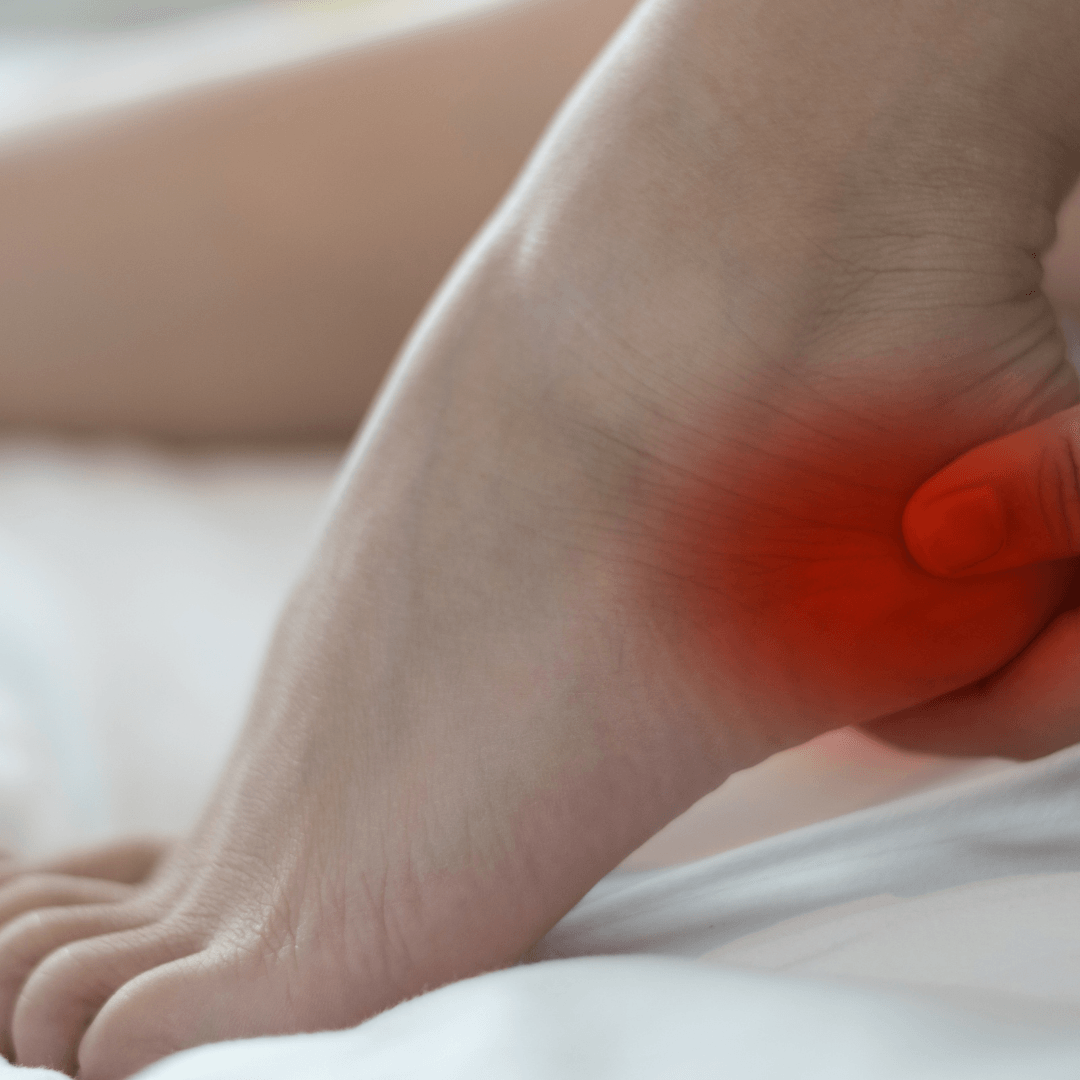 Kube Medical | Plantar Fasciitis pain