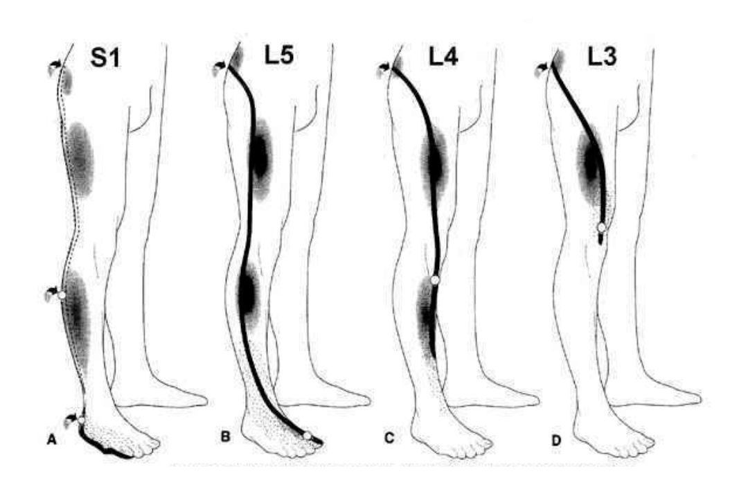 Kube Medical | Pain referral patterns