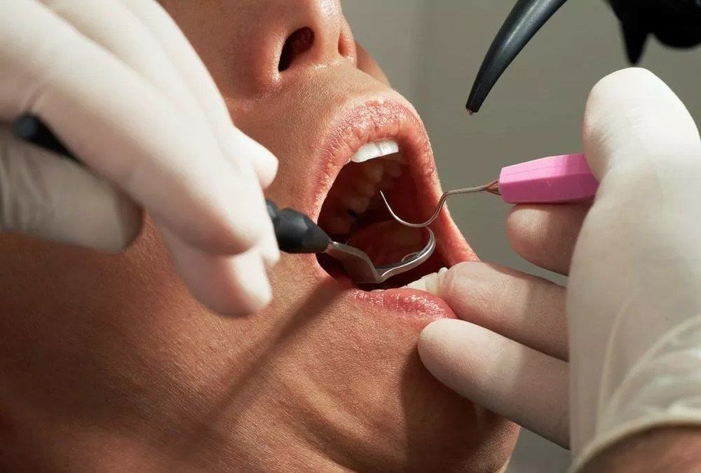 dental-sterilization