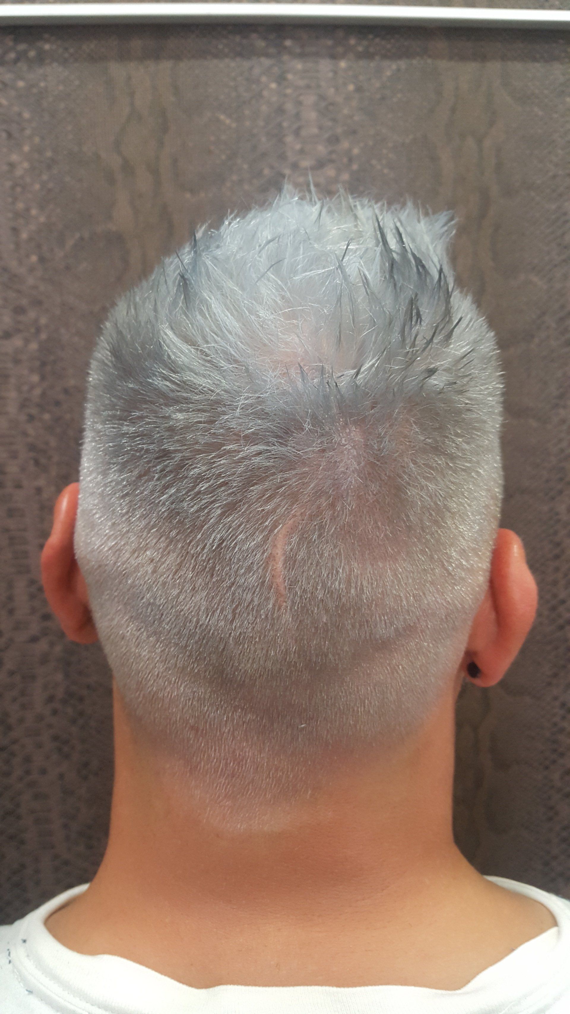 La parte posterior de la cabeza de un hombre con cabello gris.