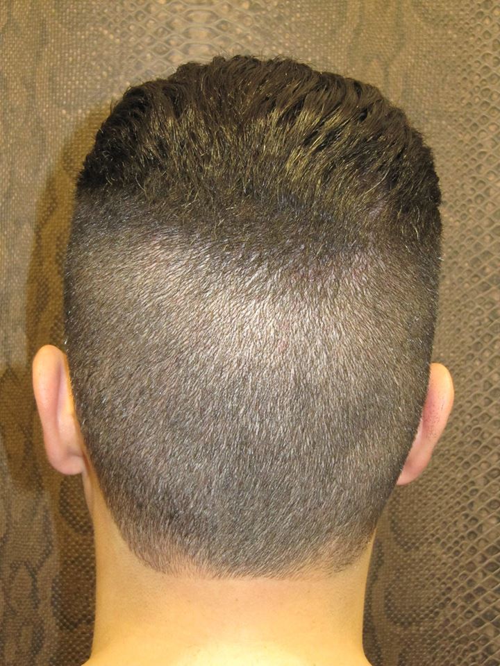 La parte posterior de la cabeza de un hombre con un corte de pelo muy corto.