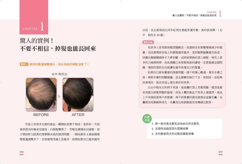 頭髮有救了!奇蹟育髮聖經