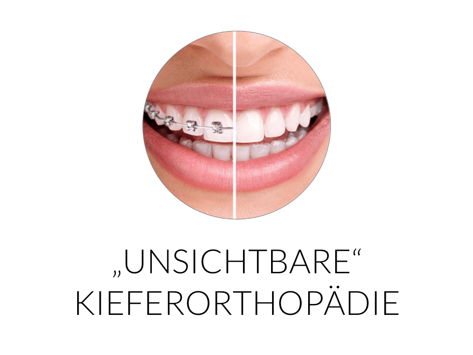 Unsichtbare Kieferorthopädie mit Incognito