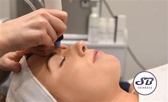 Woman receiving a facial treatment with a handheld device; indoors, light skin.