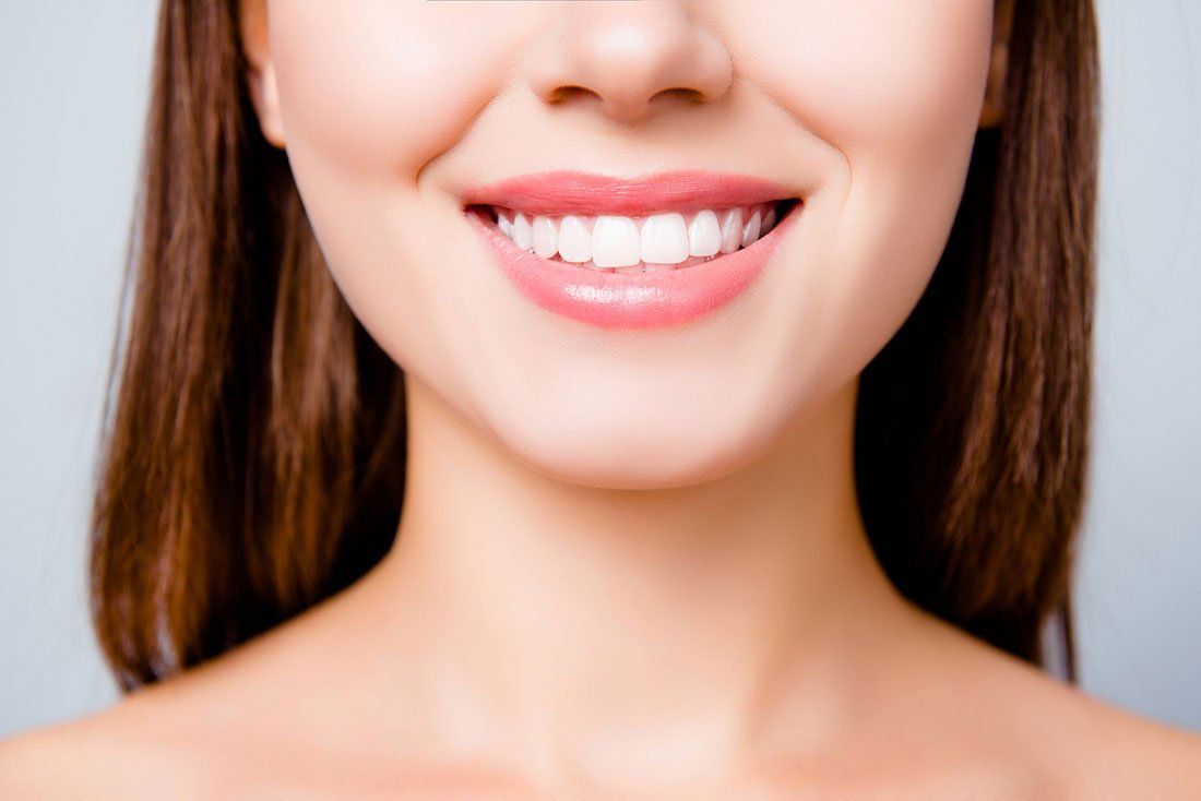 Bonding — Smile Of A Woman After Dental Bonding in Tukwila, WA