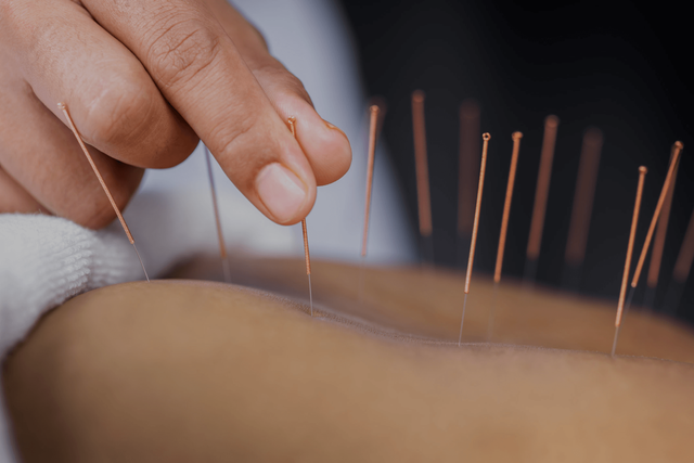 Cosmetic Acupuncture