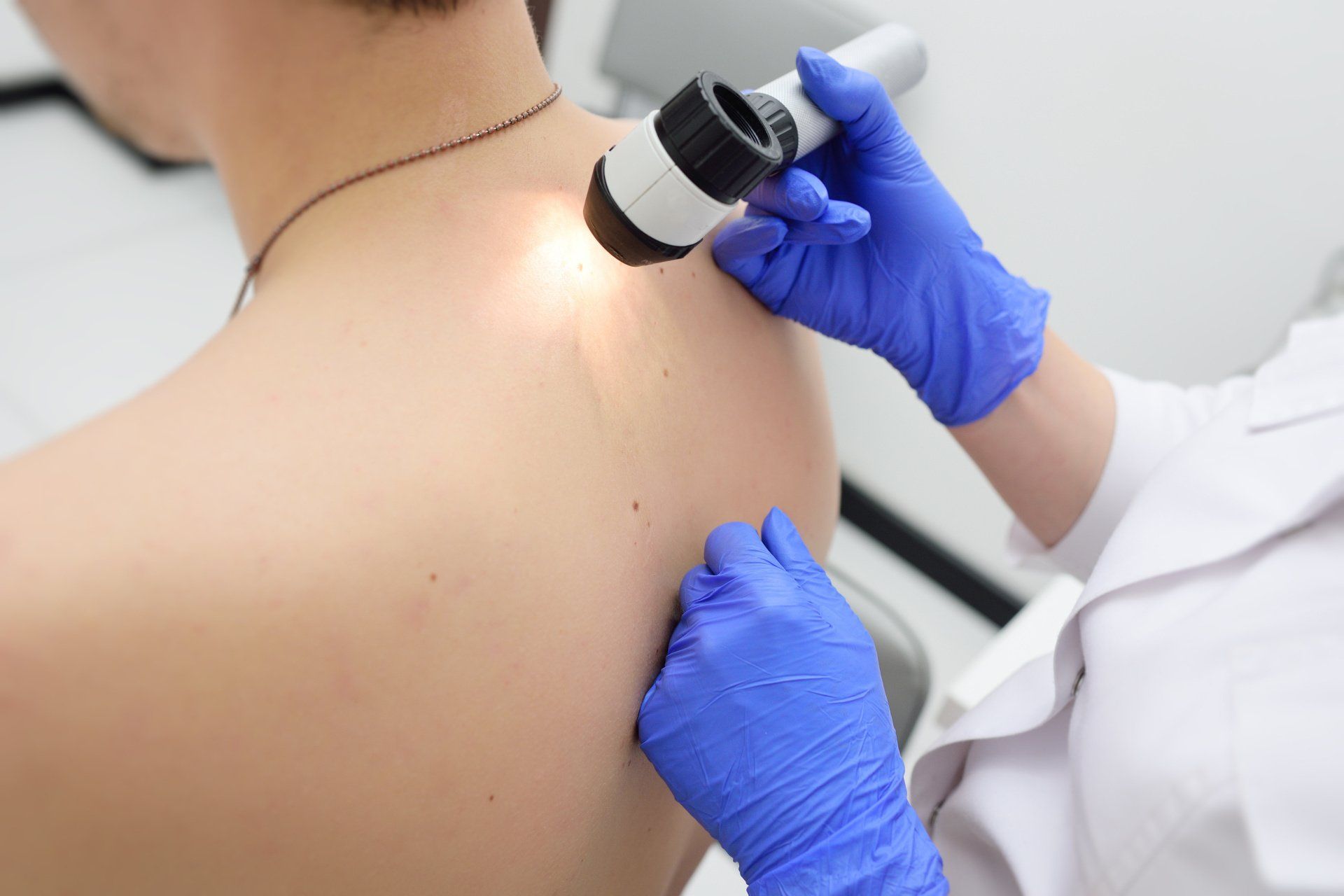 Skin lesion removal treatment