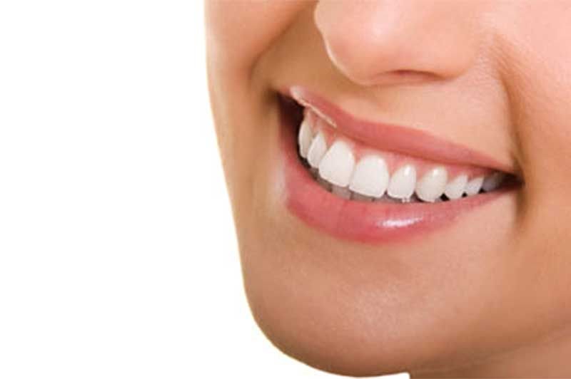 A close up of a woman 's smile with white teeth.