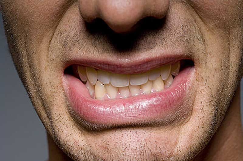 A close up of a man making a funny face with his mouth open.