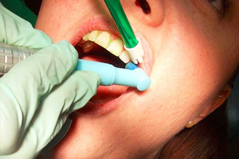 A woman is getting her teeth examined by a dentist.