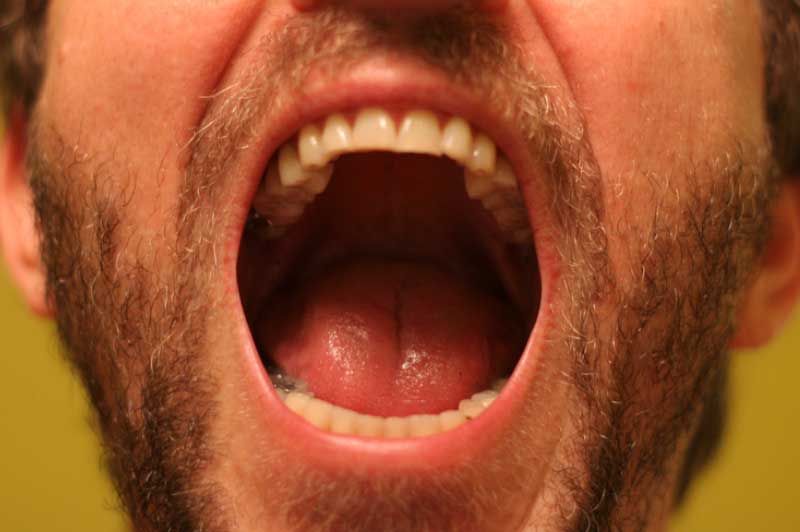 A man with a beard is screaming with his mouth open.