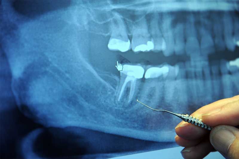 A person is holding a toothbrush in front of an x-ray of a person 's teeth.