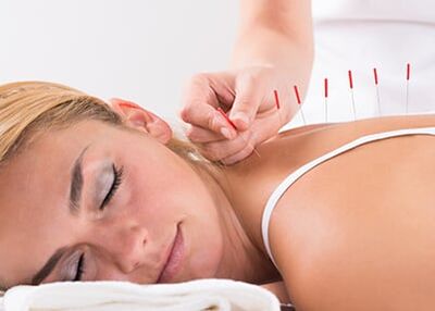 Acupuncture Treatment - Back Pain in Bonita Springs, FL