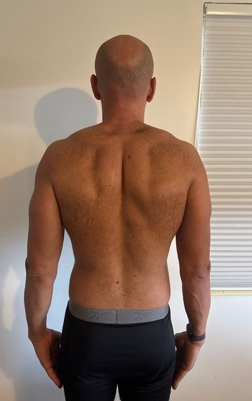 Man with bare back and arms, in dark pants. Shows back muscles, standing in front of a white wall and a window.