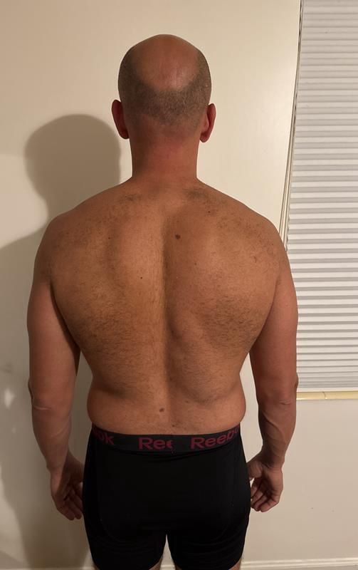 Man's back view, bald head, wearing black underwear, visible muscles, standing against a neutral wall.