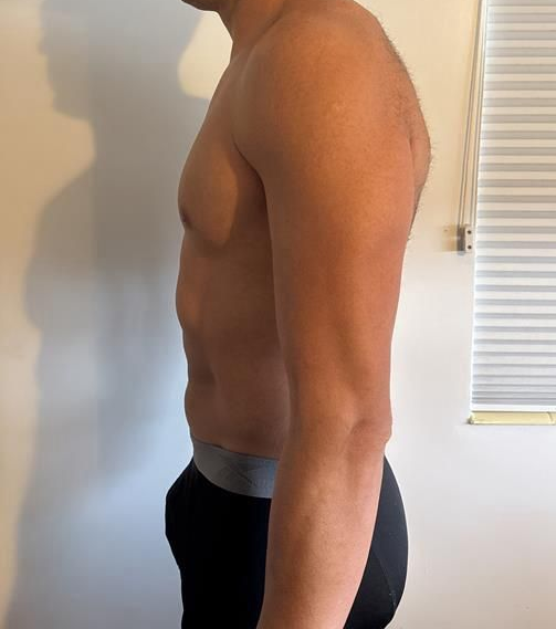 Man in dark pants, torso visible, stands facing right. Slight forward head posture, rounded upper back.