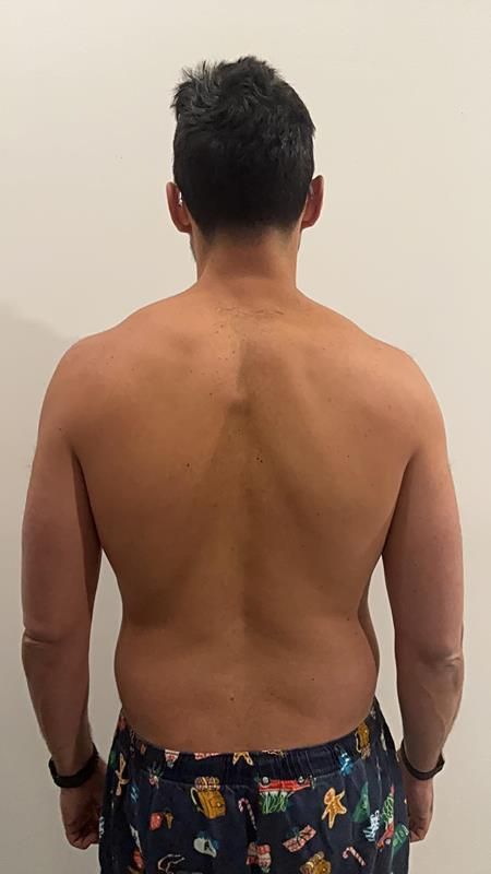 Man's bare back against a white wall; showing muscular shoulders and lower back, wearing shorts.