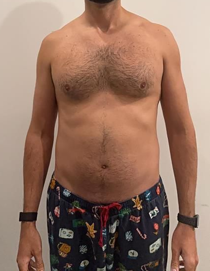 Man with dark chest hair and belly in holiday pajama pants, arms at his sides, wearing a smartwatch on each wrist.