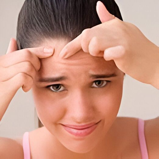 DRA. GLORIA MARGARITA LÓPEZ WENCE - Acné