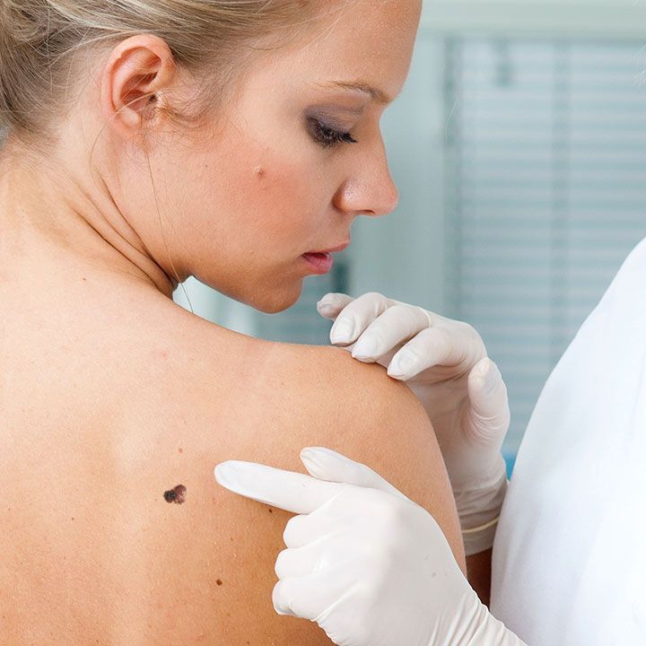 DRA. GLORIA MARGARITA LÓPEZ WENCE - Dermatitis atópica