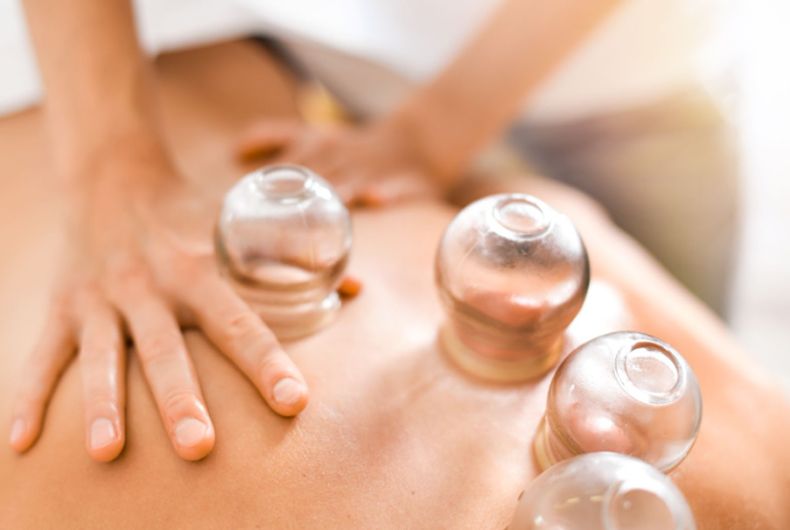A person is getting a cupping treatment on their back.