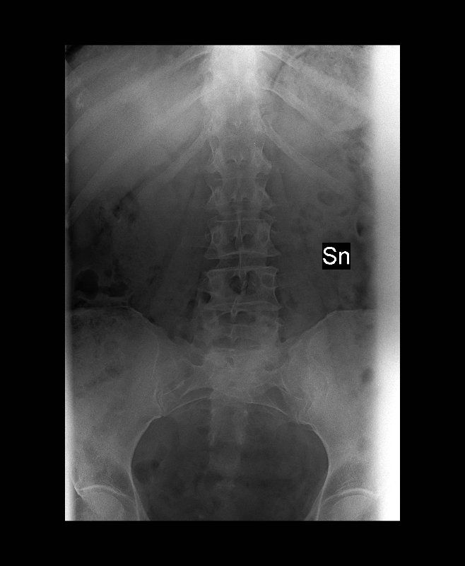 radiografia colonna vertebrale