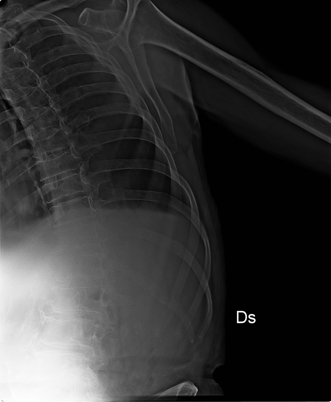 radiografia schiena