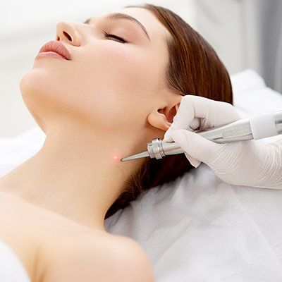 Mole Removal — Palm Desert, CA — Cosmetic Laser Solutions Mole Removal — Palm Desert, CA — Cosmetic Laser Solutions