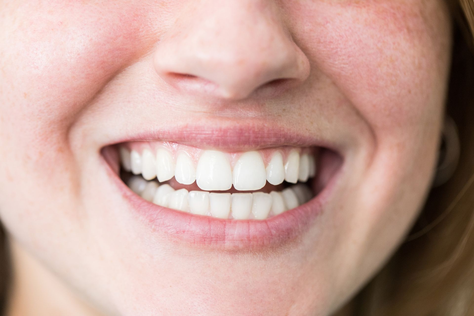 A close up of a woman 's smile with white teeth.