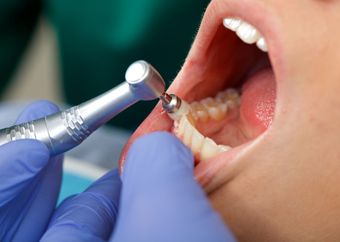 A dentist is cleaning a patient 's teeth with a drill.