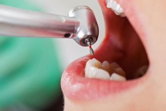 A dentist is using a drill to clean a patient 's teeth.