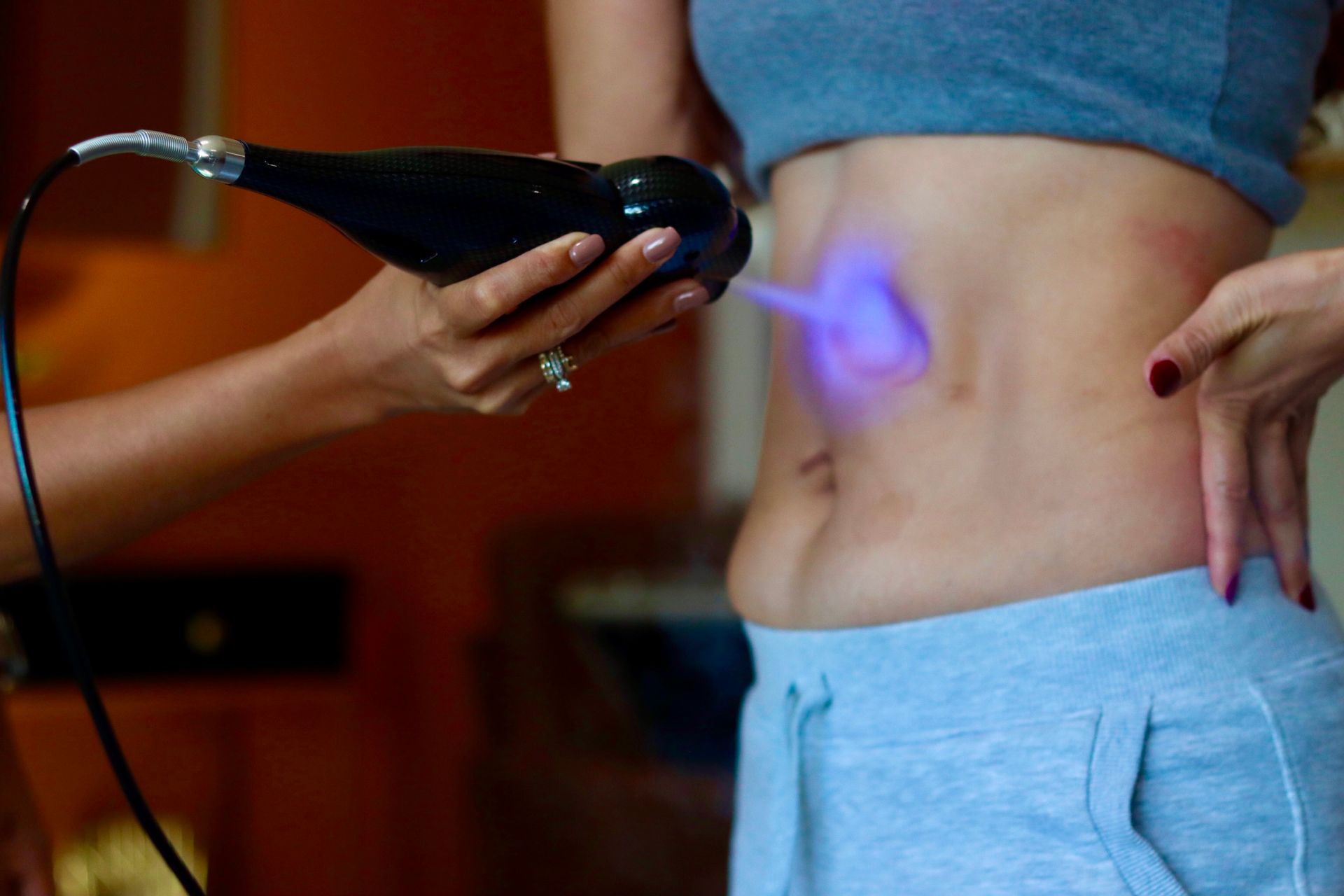 Cosmetic device treating a person's side torso with a purple glow in a spa setting