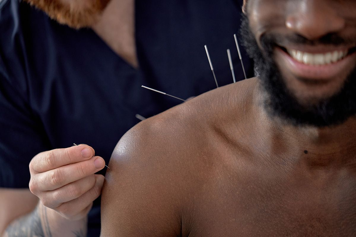 Acupuncture needle being inserted into a smiling person's shoulder by a practitioner