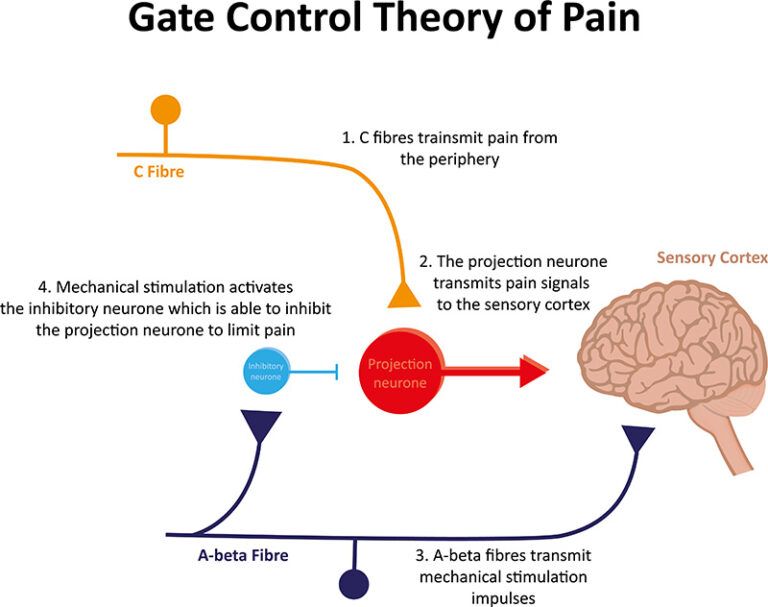 Diagram of gate control theory of pain with sensory, C, and A-beta fibers sending signals to the brain.
