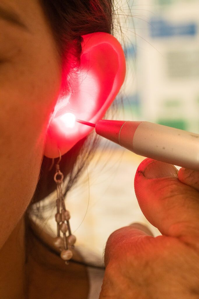 Laser device applied to glowing ear during ear acupuncture treatment