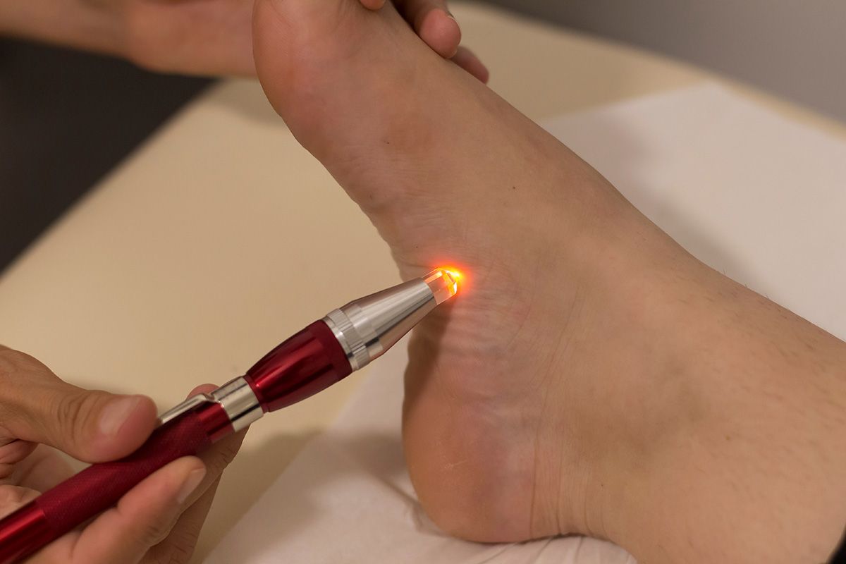 Laser device treating heel on a foot in a clinical setting