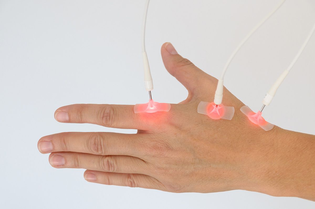 Hand with three red laser therapy probes on the back, emitting red light against a white background