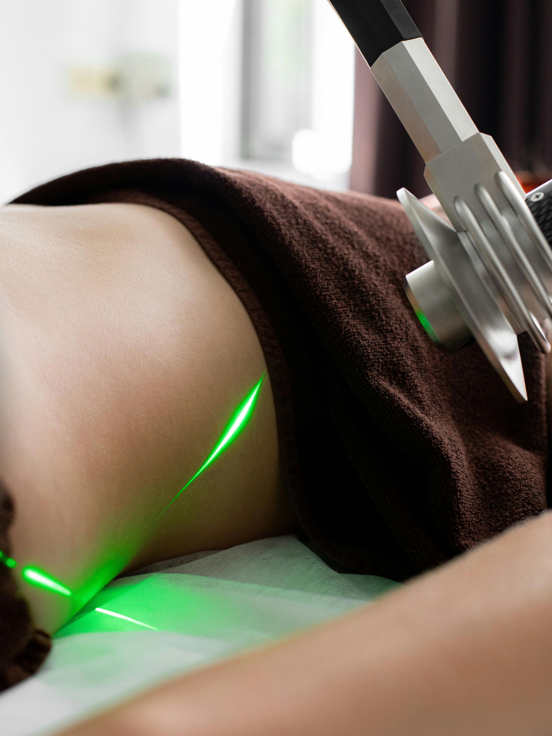 Laser treatment on skin near a metal device, with green laser lines visible