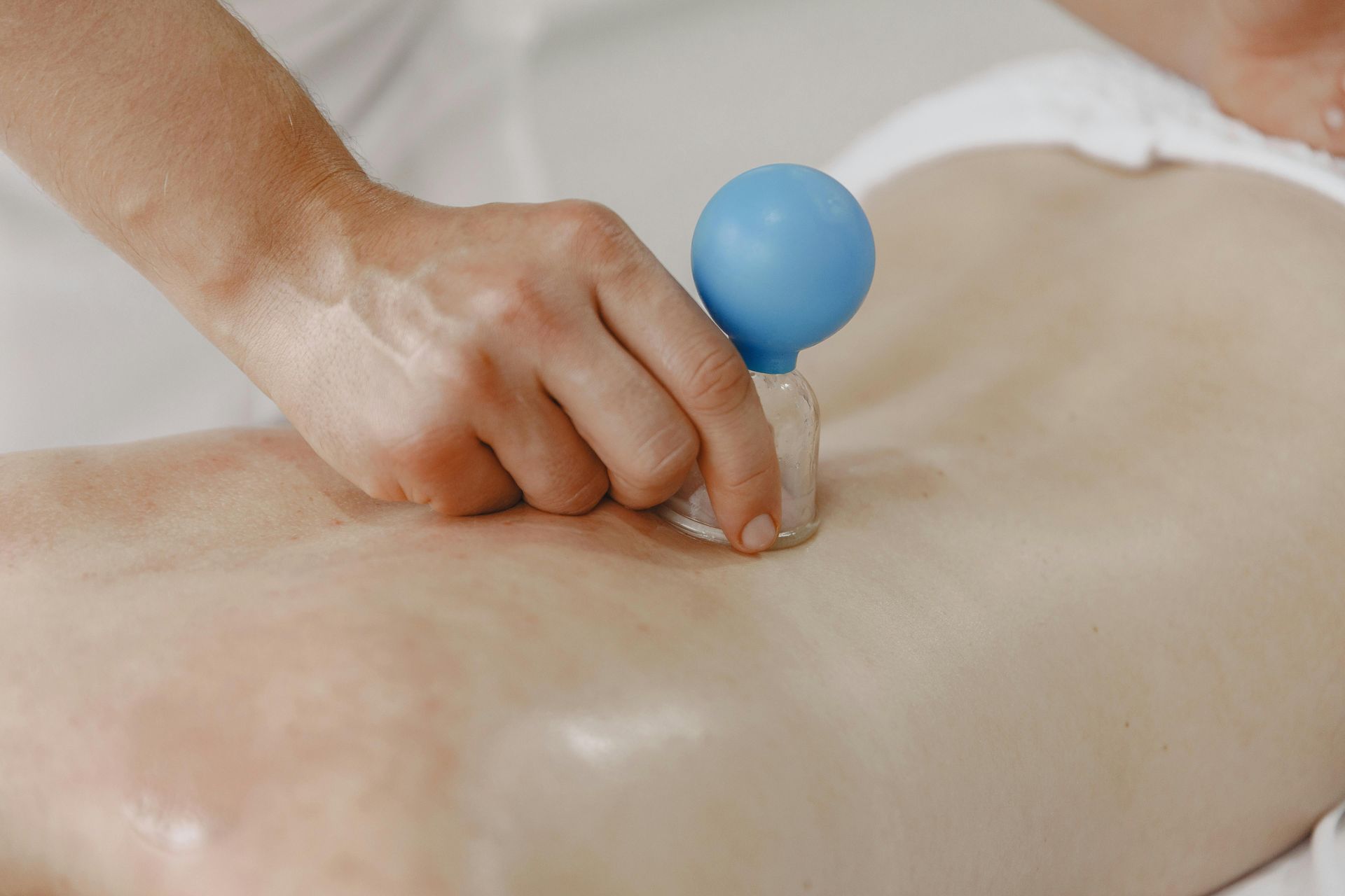 Hand pressing a blue suction cup on a person's bare back during massage or therapy