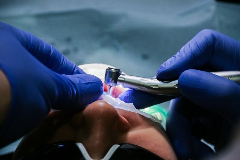Denver Sedation Dentist