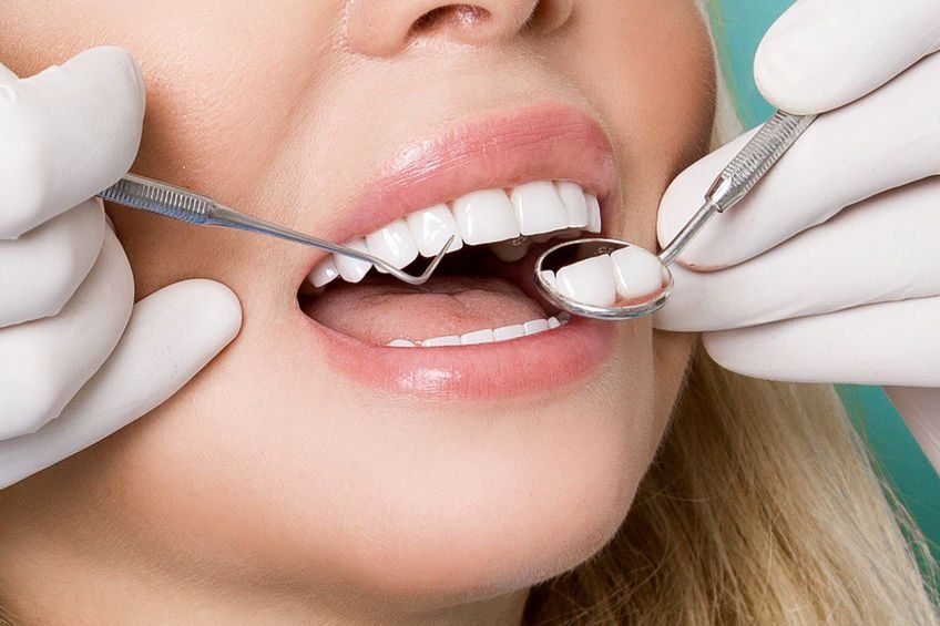 porcelain veneers sedation dentist teeth appearance