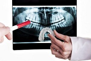 Teeth Grinding Visits To Sedation Dentist