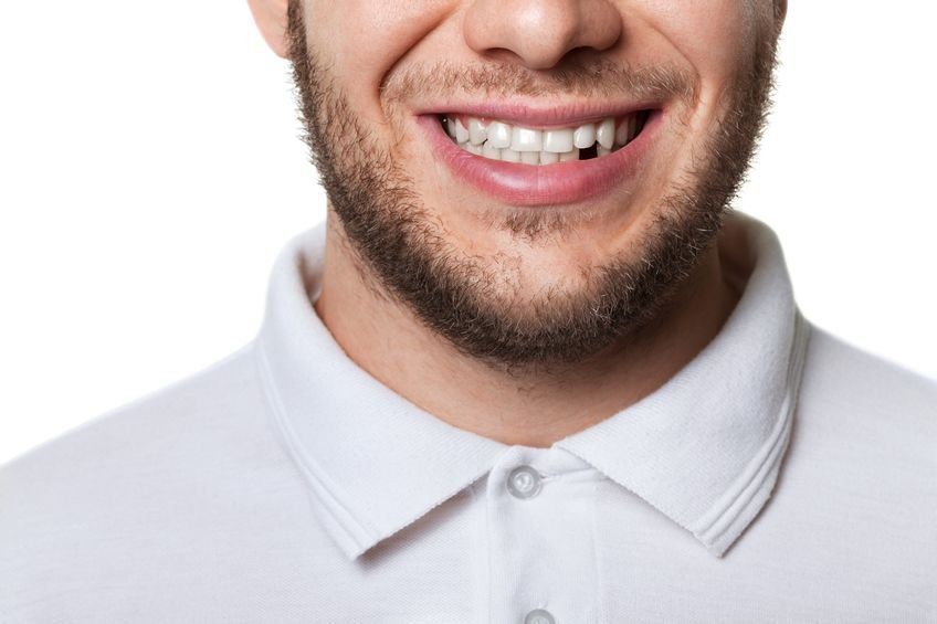replacement of missing teeth sedation dentistry works