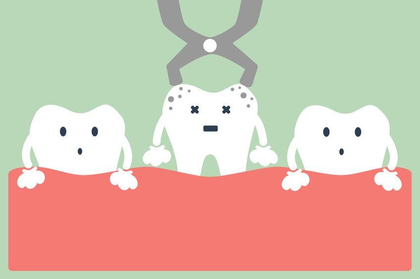 tooth extraction sedation dentistry ease the pain