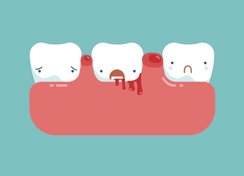 little nervous try sedation dentistry oral health