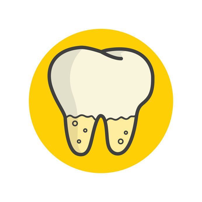 See Sedation Dentist For Deep Cleaning Remove Plaque