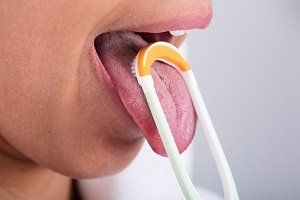 cleaning tongue sedation dentist recommends