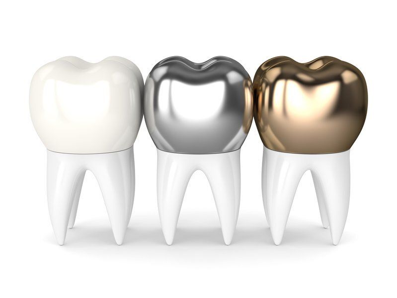 types of crowns sedation dentistry installation porcelain gold
