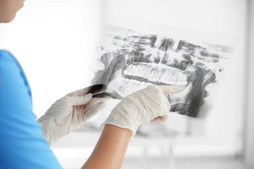 jaw pain x-ray sedation dentistry assistant