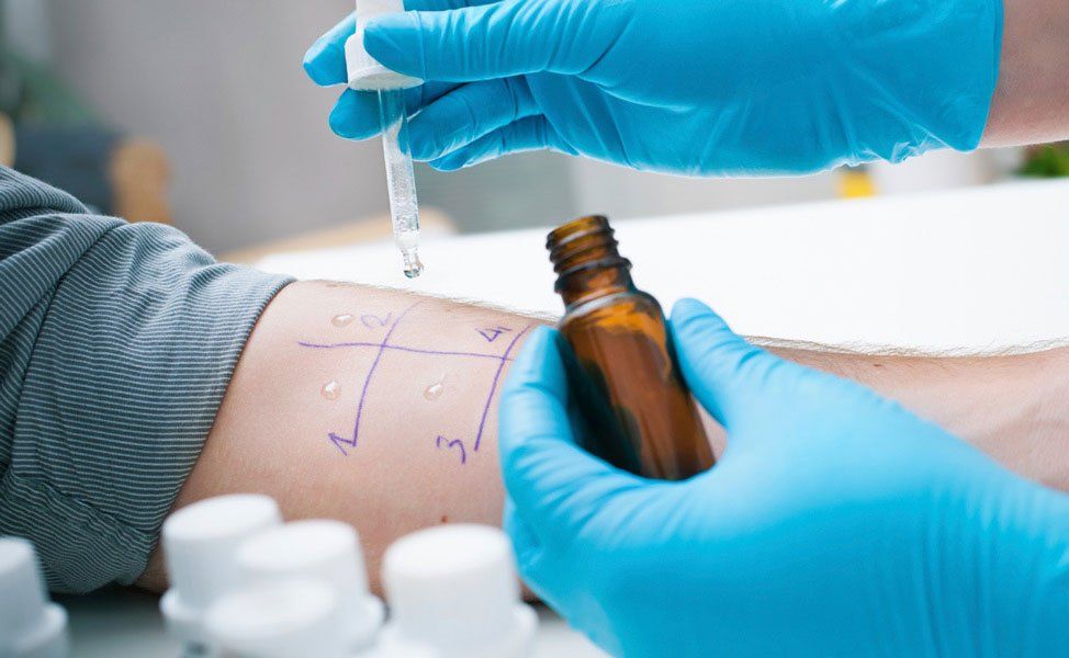 immunologia allergologia